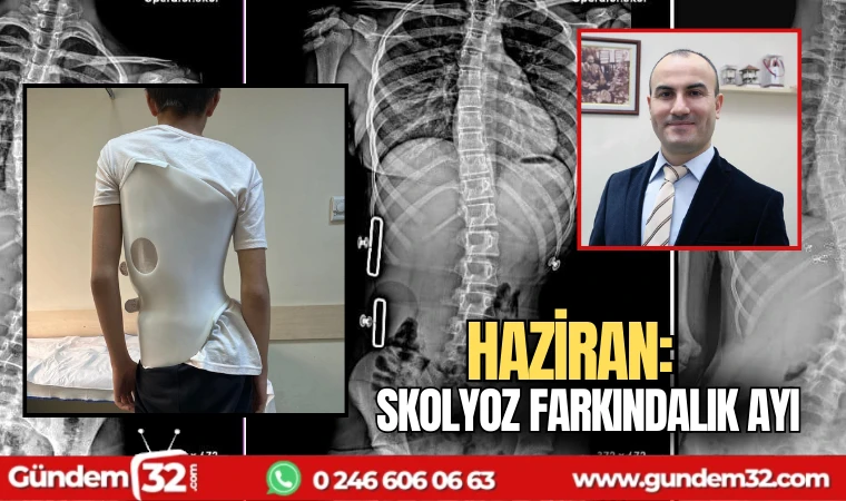 Haziran: Skolyoz Farkındalık Ayı