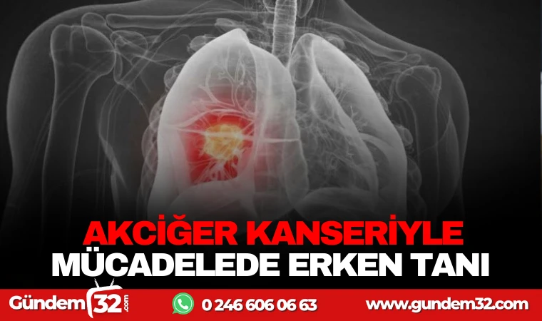 AKCİĞER KANSERİYLE MÜCADELEDE ERKEN TANI